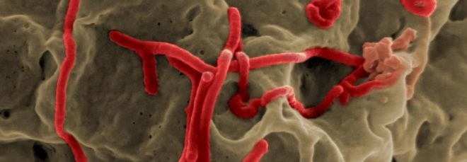 ebola, ebola virus, ebola microscope