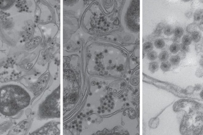 virus, viruses, new viruses, new virus family