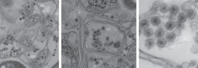 virus, viruses, new viruses, new virus family