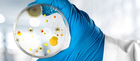 carbapenem-resistant Enterobacteriaceae, CRE bacteria, CDC, ARLN, Antibiotic Resistance Laboratory Network, antibiotic resistance, antibiotic resistant bacteria, bacteria, deadly bacteria, nightmare bacteria