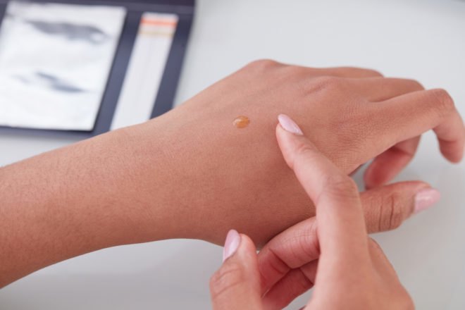 person rubbing skincare serum into her hand